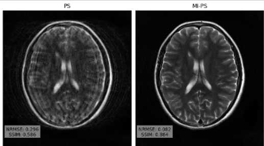 Accelerated Motion Correction with Deep Generative Diffusion Models