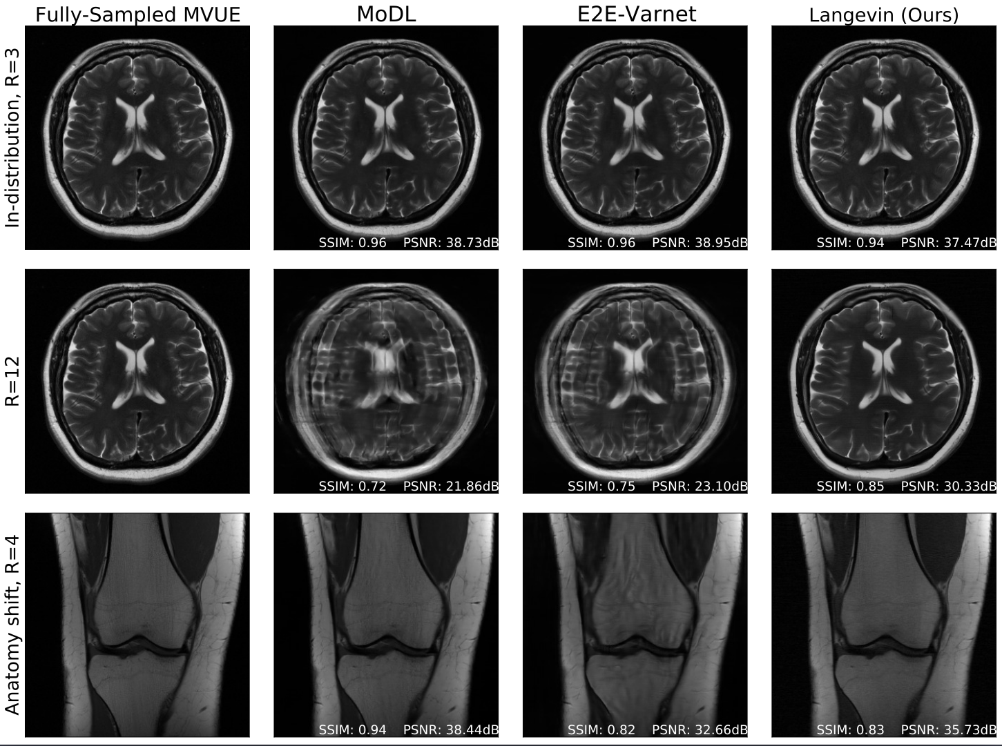 Robust compressed sensing MRI with deep generative priors