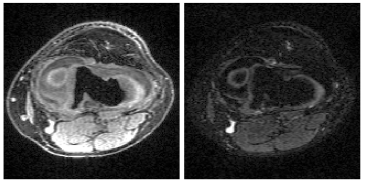 MRI reconstruction with side information using diffusion models